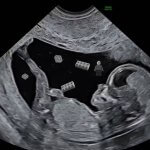 Lego Launches Microplastic Bricks for Prenatal Babies